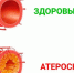 Берегите сосуды - Администрация г. Бердск